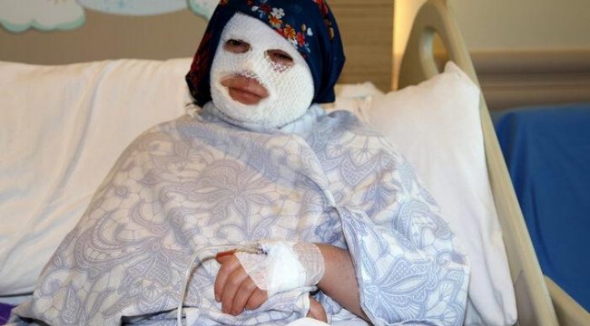 Düdüklü tencere bomba gibi patladı! Kâbusu yaşadı